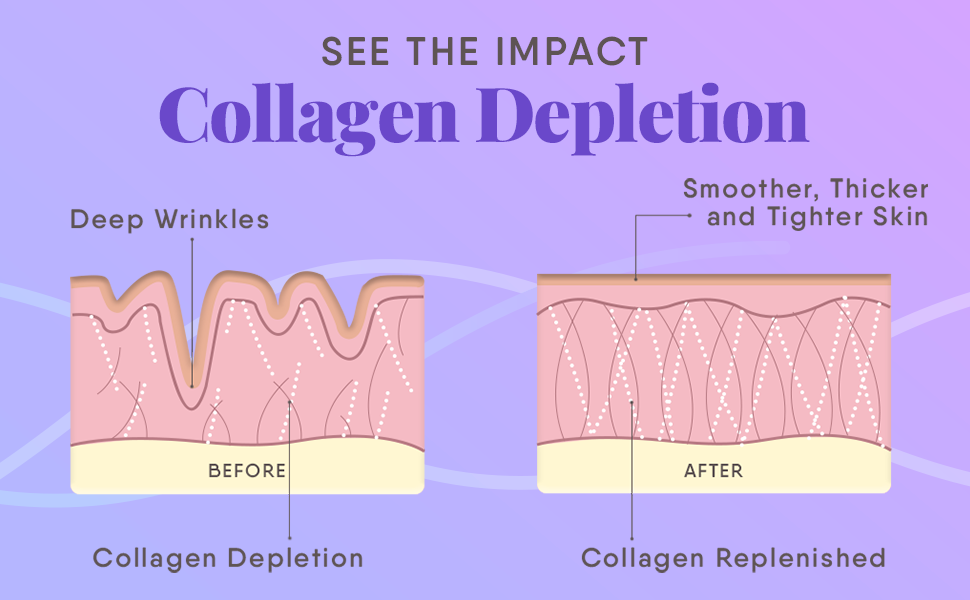 Trunativ Collagen Supplements | Advanced Japanese Marine Collagen Powder for Women & Men | Type 1 and 3 Hydrolyzed Peptides | Supplement with Hyaluronic Acid | Supports Skin Glow, Hair Growth, and Nail Strength | Blueberry Lavender (200g)