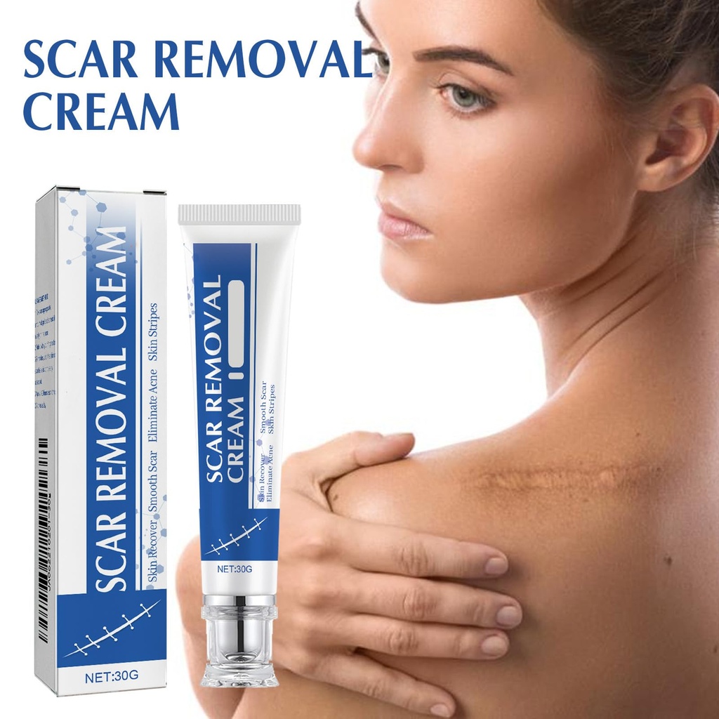 scar-cream-scar-removal-cream-silicone-s-2.jpg