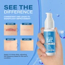 bruizex-5-in-1-scar-cream-for-surgical-s-4.jpg