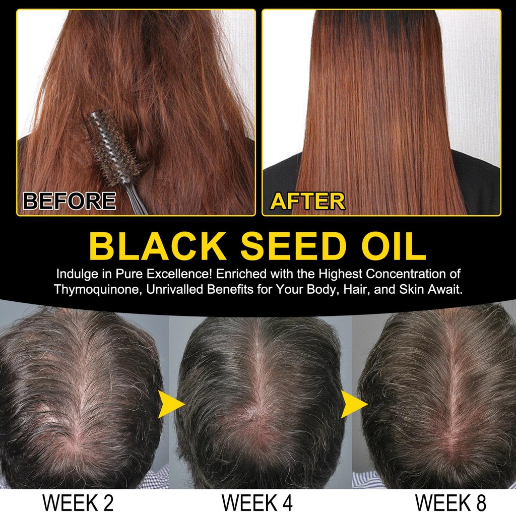 2-pack-black-seed-oil-organic-cold-press-3.jpg