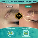silicone-scar-gel-massage-design-for-fas-4.jpg
