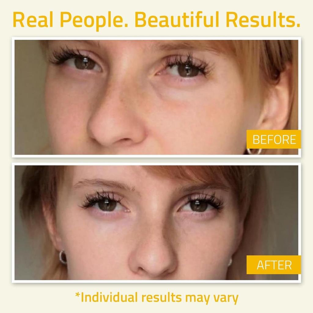 yeouth-under-eye-gel-with-hyaluronic-aci-4.jpg