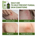 roycederm-clotrimazole-1-antifungal-spra-81muD7dE-UL.jpg