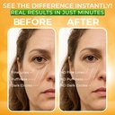 puffy-eye-treatment-instant-results-natu-4.jpg