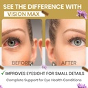 antioxidant-eye-immune-support-supplemen-2.jpg