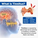 acupeace-tinnitus-relief-device-acupeace-3.jpg
