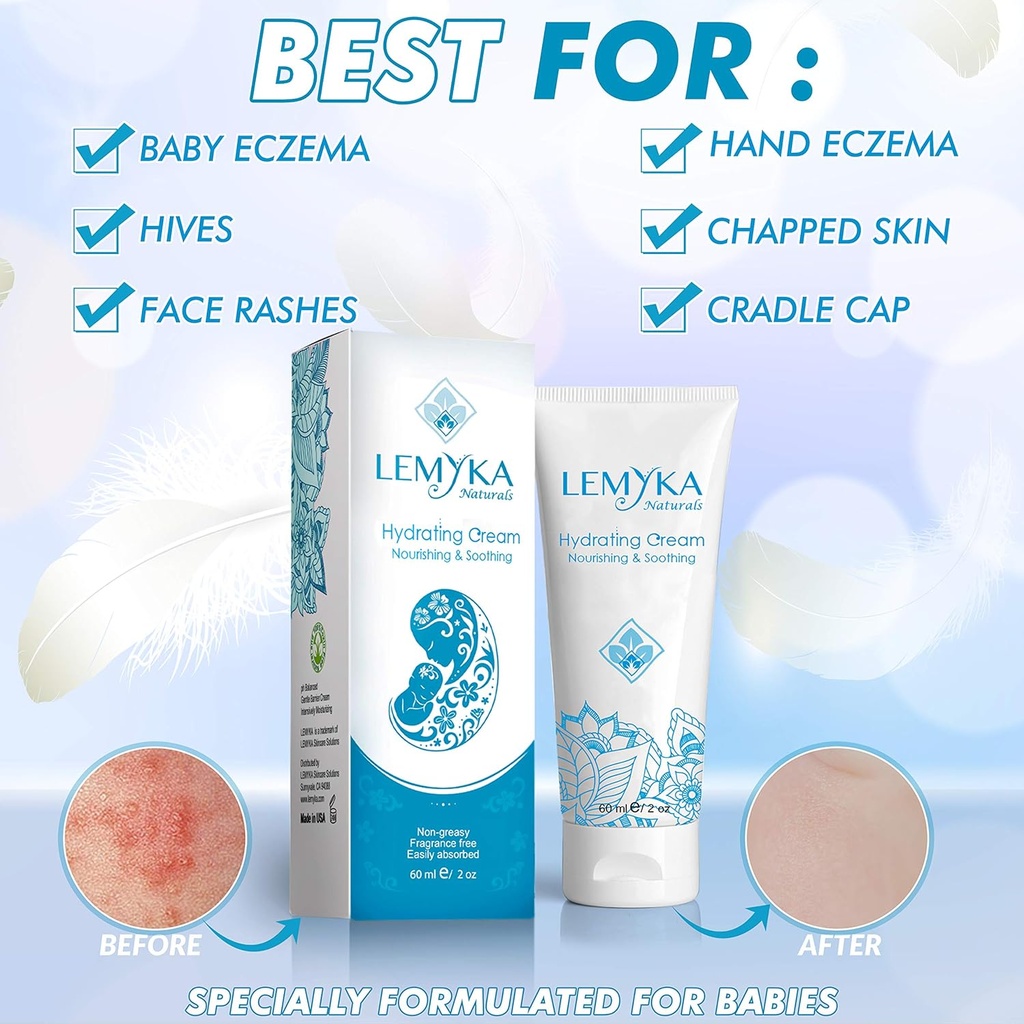 baby-eczema-cream-for-dry-itchy-skin-soo-2.jpg