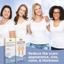breast-silicone-scar-sheets---comfortabl-4.jpg