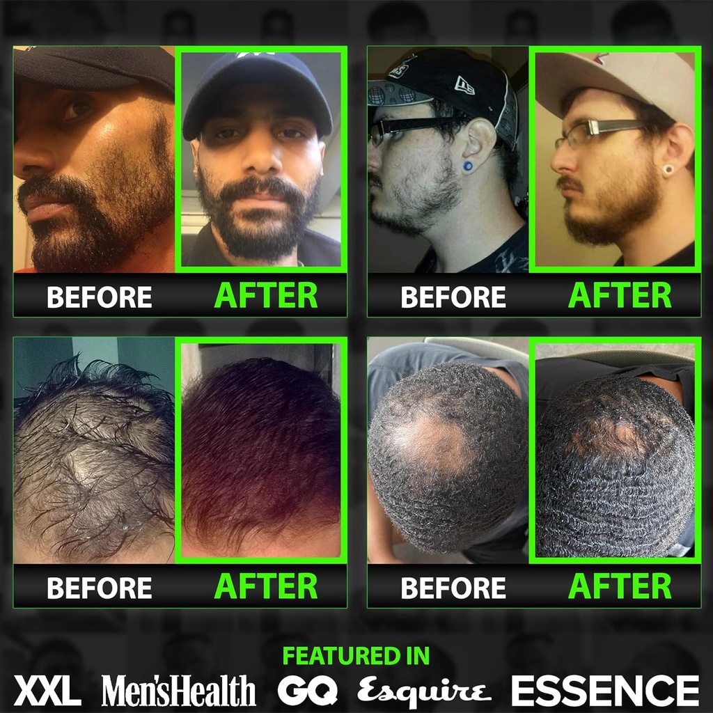 beard-growth-kit-wgrow-11-in-1-hair-grow-3.jpg