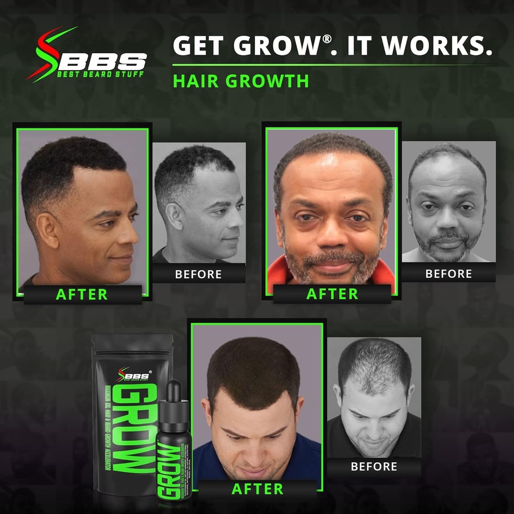 beard-growth-kit-wgrow-xxl-beard-oilseru-4.jpg