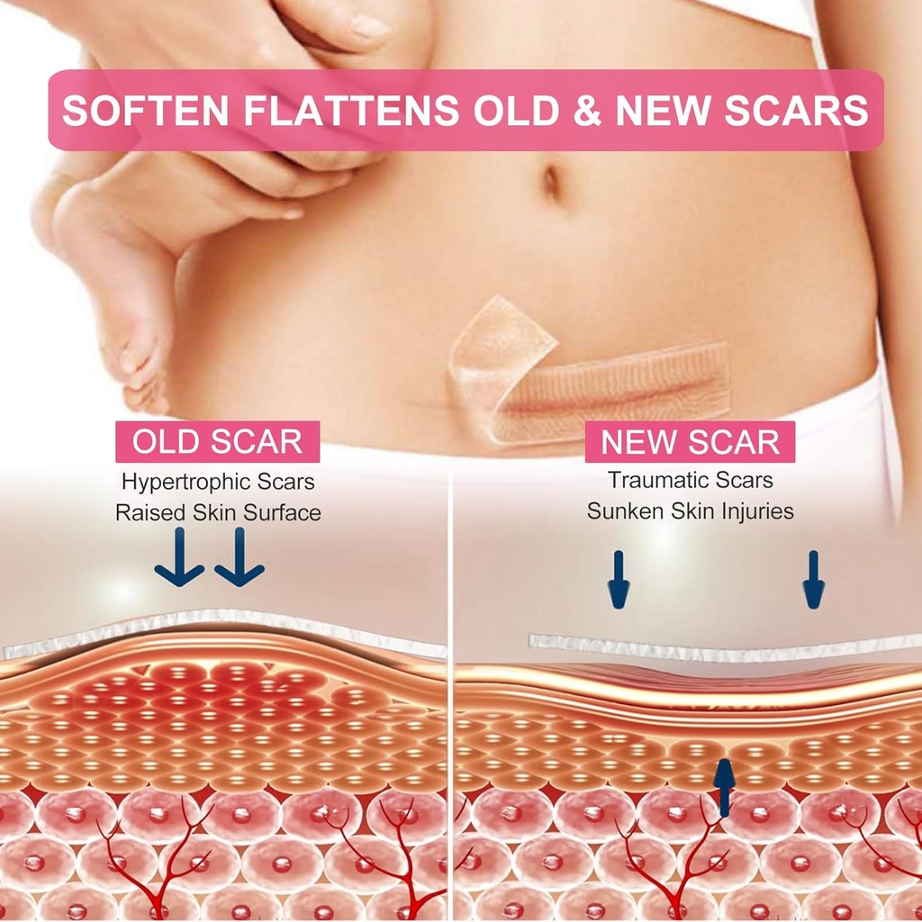 silicone-scar-sheets-clear-silicon-gel-s-2.jpg