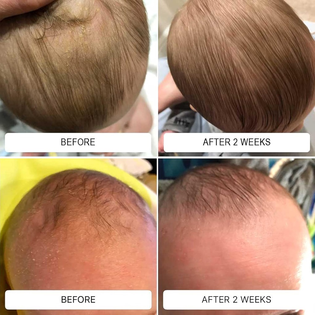 happy-cappy-daily-medicated-shampoo-and--4.jpg