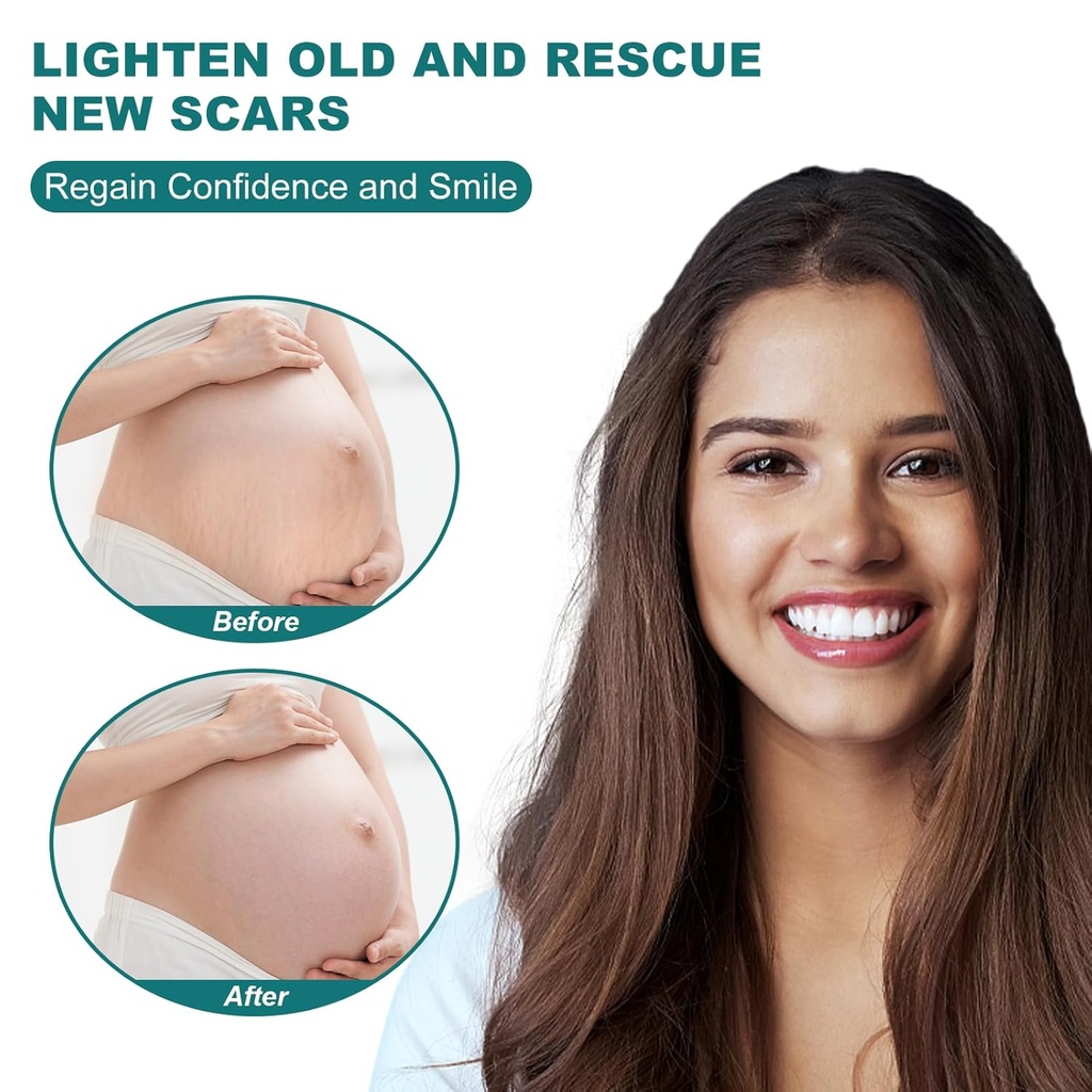 silicone-scar-sheets-16x-79-roll-2m-sili-4.jpg