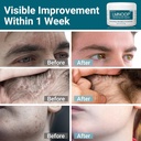 seborrheic-dermatitis-cream-extra-streng-4.jpg