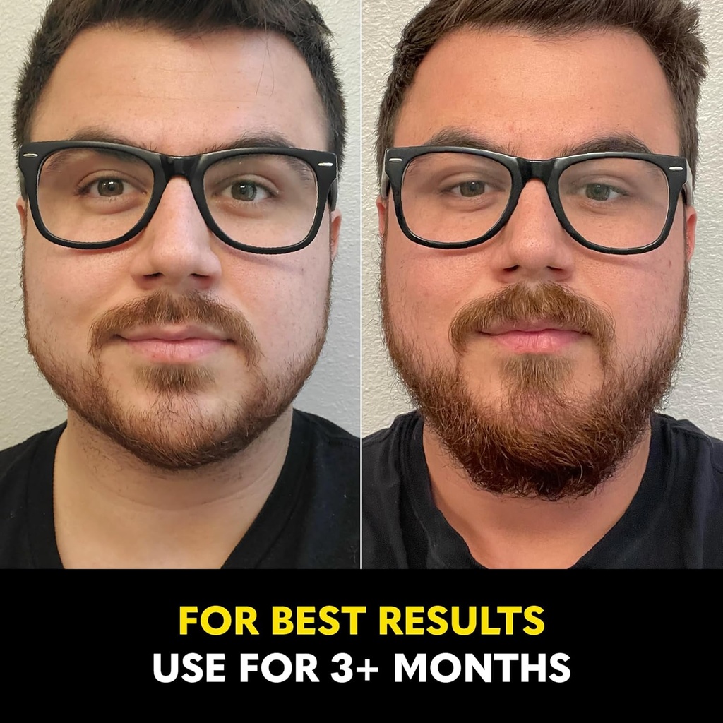 beard-club---beard-growth-serum-with-nat-6.jpg