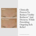 murad-eczema-control-daily-defense-collo-3.jpg