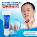 gengigel-hyaluronic-acid-oral-gel-for-mo-2.jpg