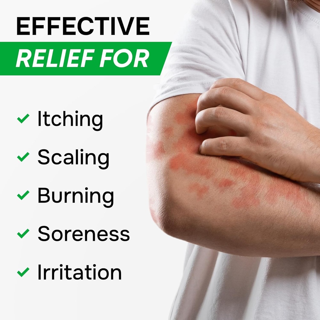 antifungal-cream-for-athletes-foot-ringw-4.jpg