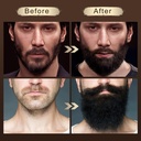 pop-modernc-beard-growth-kit-beard-groom-5.jpg