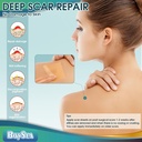 boysea-silicone-scar-sheets-16-x-120-cle-4.jpg