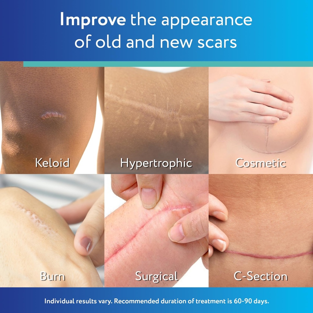 scaraway-advanced-clear-silicone-scar-sh-3.jpg