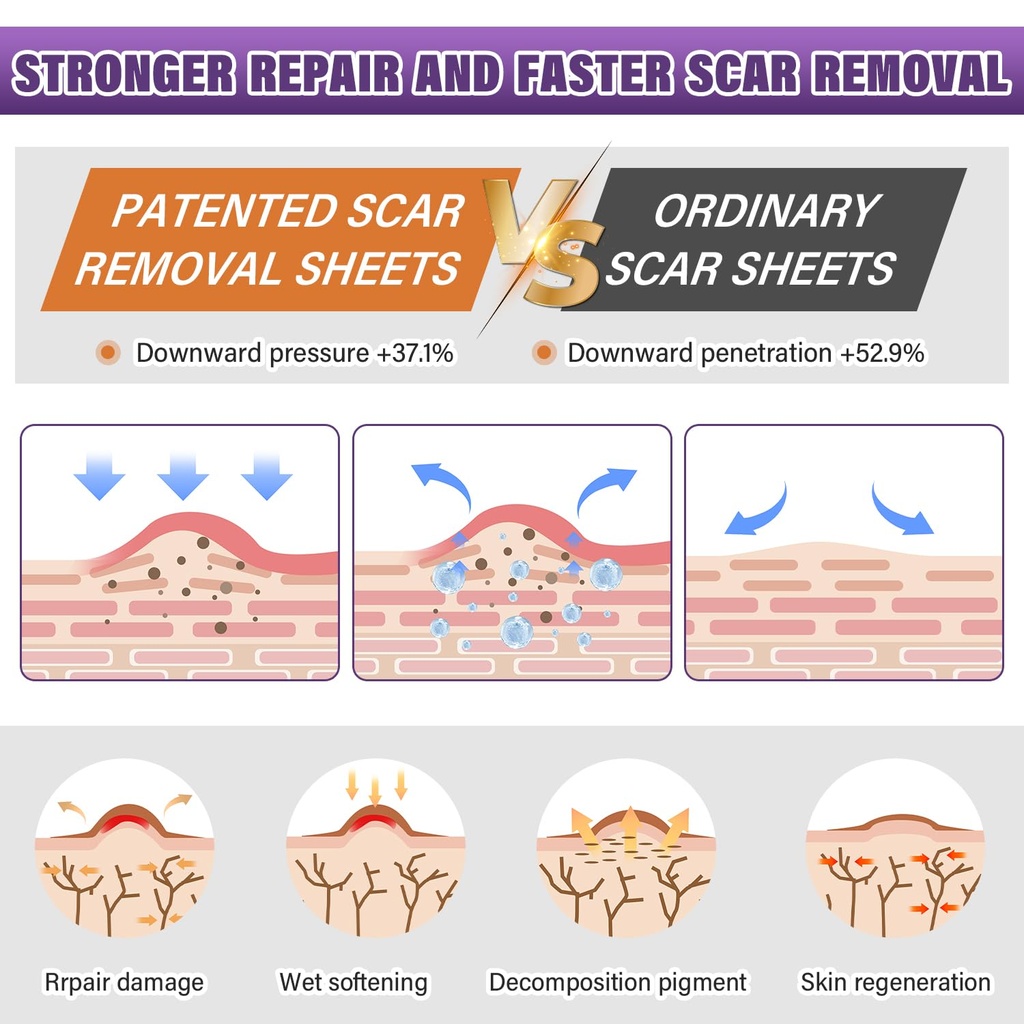 silicone-scar-sheets-silicone-scar-tape--3.jpg