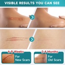 pumkot-silicone-scar-sheets-silicone-sca-2.jpg