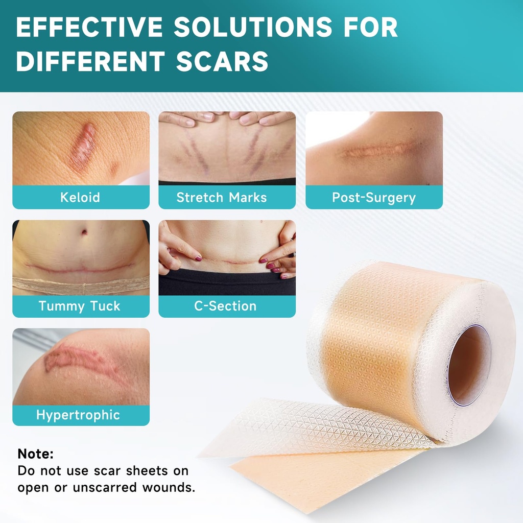 pumkot-silicone-scar-sheets-silicone-sca-3.jpg