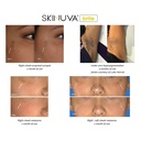 skinuva-complete-care-system-scar-spf-30-4.jpg