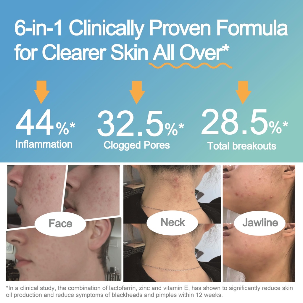 life-space-acne-relief-skin-rebalance-pr-2.jpg
