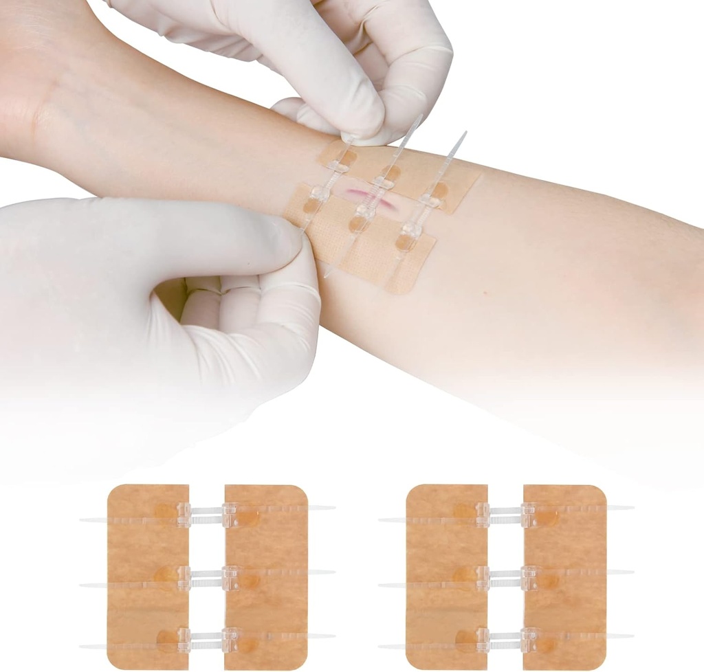 Zip Stitch Laceration תיקון ללא Stitches Butterfly Bandaids מהיר Clot - חירום Wound Closures התקן 2 Pieces(PU)