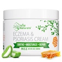 Wild Naturals Eczema & Psoriasis קרם עבור יבש, Itchy Skin - אקסמה הקלה למבוגרים וילדים - Moisturizing Psoriasis קרם עם Manuka דבש - הידרה דבש ללקות ידיים ו Face Face Face Face
