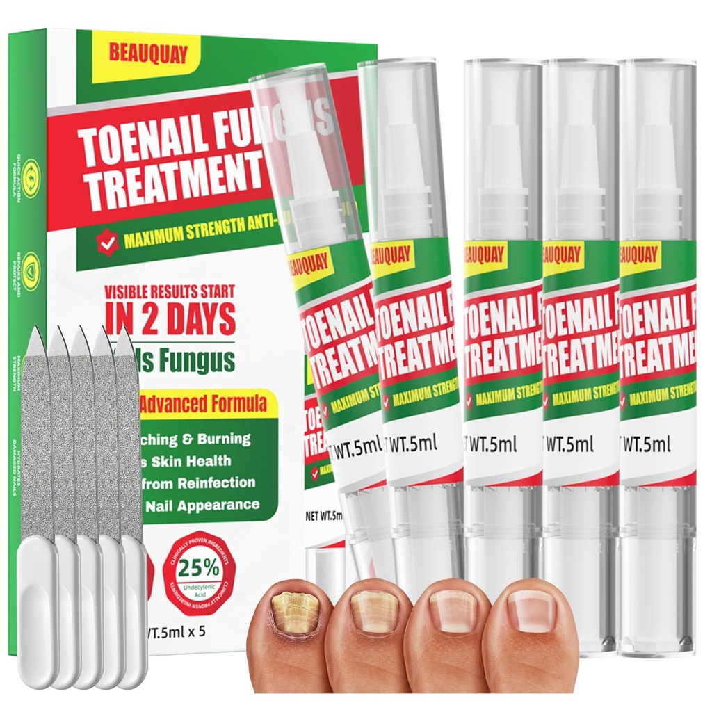 Toenail Fungus Treatment Extra Strength-Toenail Fungus Treatment Pen, Fast Acting Nail Strengthener and Growth Pen for Repairs Fungal Damaged, Yellow, Thick, Discolored Nails, Results in 2 Days