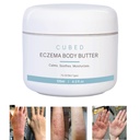 oz Eczema Cream for Adults, Eczema Relief, Eczema Treatment, Moisturize יבש Irridated Skin, Smart Lotion for Topical Steroid , Psoriasis & Rosacea, Eczema, Dermatitis