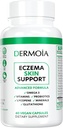 תוספי אקסמה - פורמולה Dyshidrotic Eczema Pills למבוגרים - מתן סיוע אקסמה, קידום Intervention of Eczema, Irritated יבש עור, ולהגדיל עם תוספי פסוריאזיס