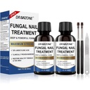 Toenail Fungus Treatment תוספת כוח עם 25% Undecyleylenic Acid, טיפול Toenail בוגר, תיקון ציפורניים, טיפול פטריגוס ציפורניים, ציפורניים צהובות, גרימת נזק לטיפול פטריית רגל עודף כוח נוסף