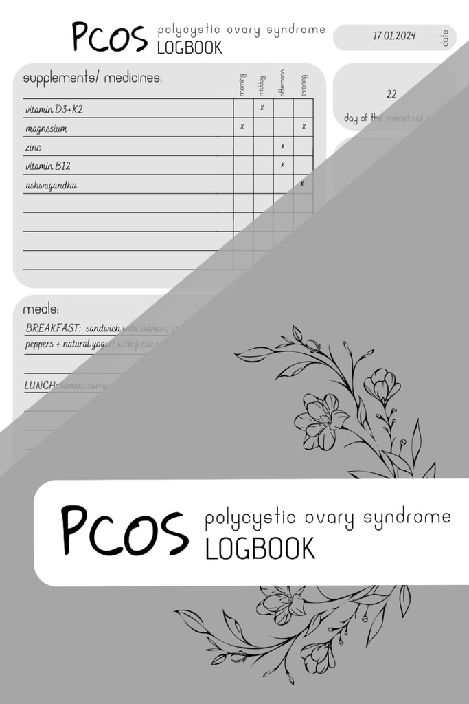 PCOS LOGBOOK: תוספי Tracker, Meal Planner, Time Tracker, 150 דפים, 6x9 ב, Minimalist Design