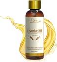Siya Ayurveda Psoriasis טיפול שמן עבור סיוע טבעי | שמן עבור Scalp Psoriasis & Skin Care | הסר פסוריאזיס מ Roots | Made with Natural Ingredients - 100 מ"ל