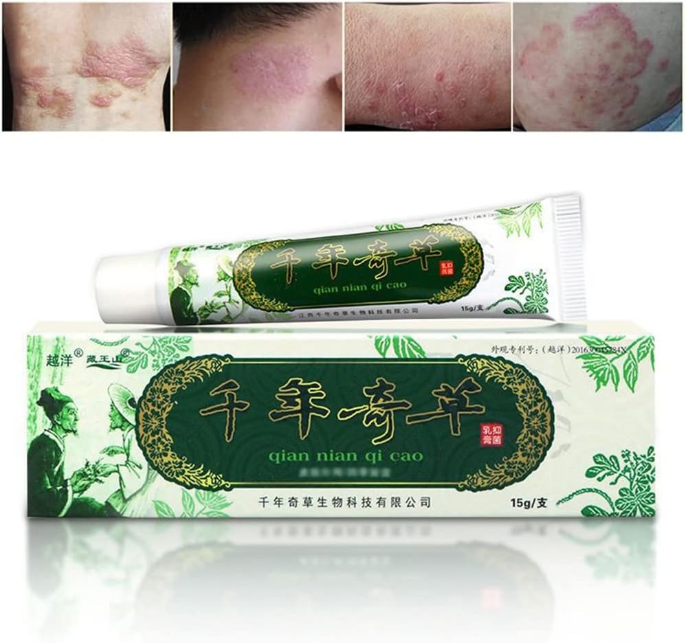 Oversea Thousand-Year Herbal Cream הסינית Herbal Eczema, Psoriasis Creams Dermatitis ו- Eczema Pruritus Psoriasis JIULIN Ointmentment
