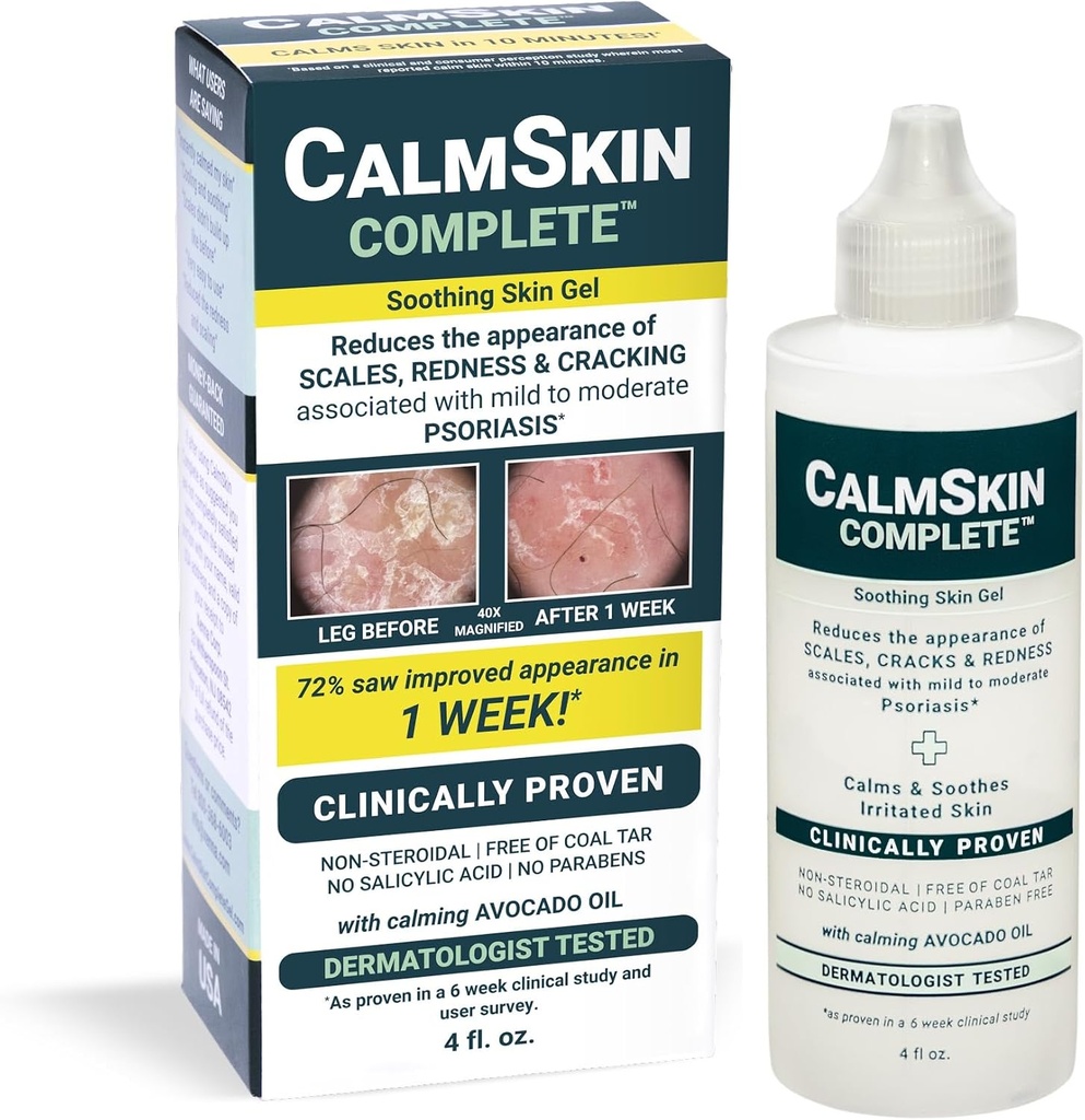Xenna CalmSkin שלם | פרובאנס קליני Soothe Irritated Skin ולשפר את הופעת העור עם מילד כדי מודראט Psoriasis | Made in the USA | 4 fl. oz.