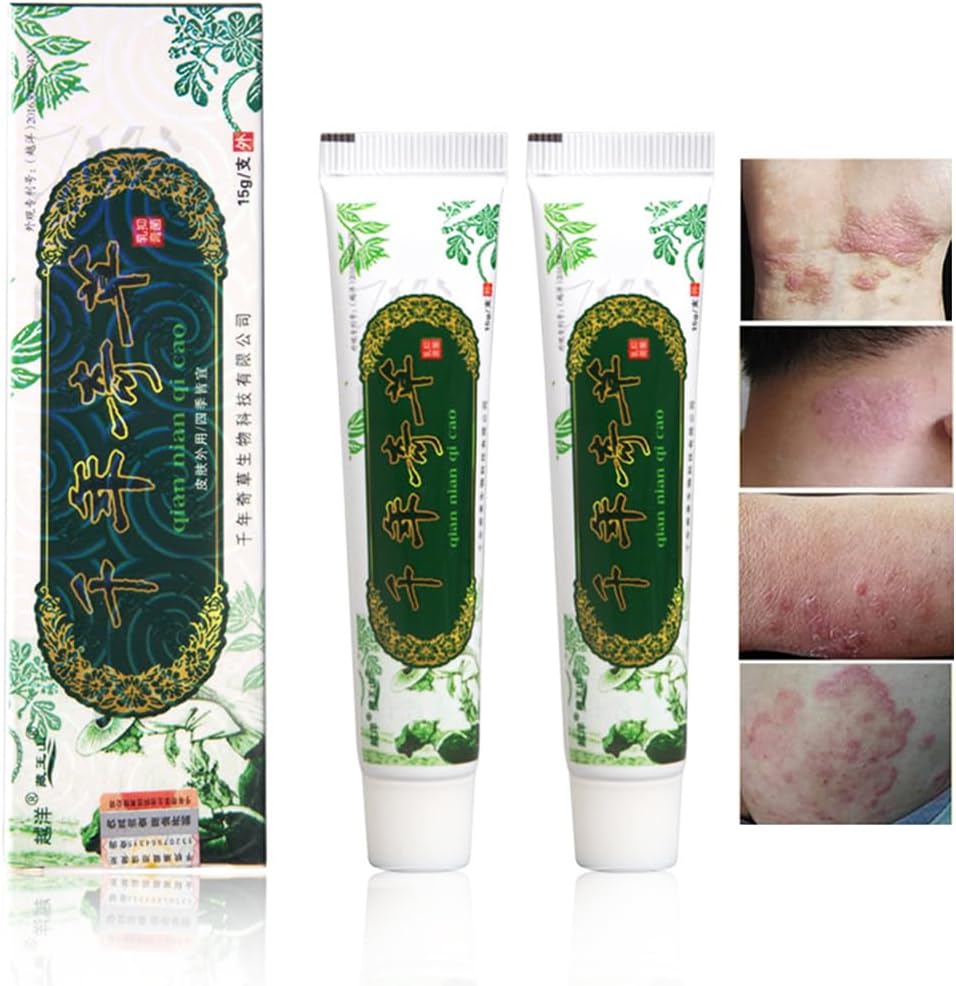 Oversea Thousand-Year Herbal Cream הסינית Herbal Eczema, Psoriasis Creams Dermatitis ו- Eczema Pruritus Psoriasis JIULIN Ointment (2PCS)