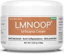קרם Urticaria, Hives להקל פורמולה מתקדמת עבור גירוד, רדום, Pimples, Rashes, Edema ותסמיני עור אחרים