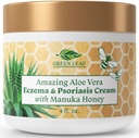 Manuka Honey Eczema Cream Moisturizing Lotion for Psoriasis Relief - Itchy, יבש עור ראש ראשי / Soothing Moisturizer for Baby, Kids, Adults - High Power & Face Cream 4oz