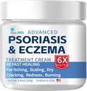 קרם Bio-MD Psoriasis Eczema, קרם אקסמה למבוגרים, תוספת כוח שליטה Reoccurrence, Relieve Symptom of Resistant, יעיל עבור Sborrheic Dermatitis, טיפול פוליקוליטיס