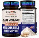 גדל ויטמין Multi Collagen קפסולות 1800MG (Types I, II, III, V & X) - Non GMO, Grass פד Collagen - תמיכה הזדקנות לשיער, עור, ריחות - גלולות חלבון לתמיכה משותפת - 90 קפסולות