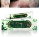 Oversea Thousand-Year Herbal Cream הסינית Herbal Eczema, Psoriasis Creams Dermatitis ו- Eczema Pruritus Psoriasis JIULIN Ointmentment