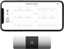 AliveCor KardiaMobile 6-Lead Personal EKG Monitor – Six Views of The Heart – Detects AFib and Irregular Arrhythmias – Instant Results in 30 Seconds – Works with Most Smartphones