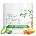 Wild Naturals Eczema & Psoriasis קרם עבור יבש, Itchy Skin - אקסמה הקלה למבוגרים ולילדים - קרם פסוריאזיס עם Manuka דבש