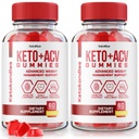 NutraRize (Pack of 2 KetoKandies Keto+ACV) חניכיים לירידה במשקל, תוספת כוח מקסימלית, Keto Kandies ביקורות (120 חניכיים)