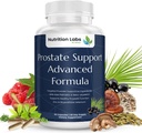 Prostate Health תומך בתוסף צמחי לגברים עם Beta Sitosterol, Selenium, Pygeum ו Saw Palmetto לחלץ תמיכה Prostate ו Frequent Urination - 90 CT